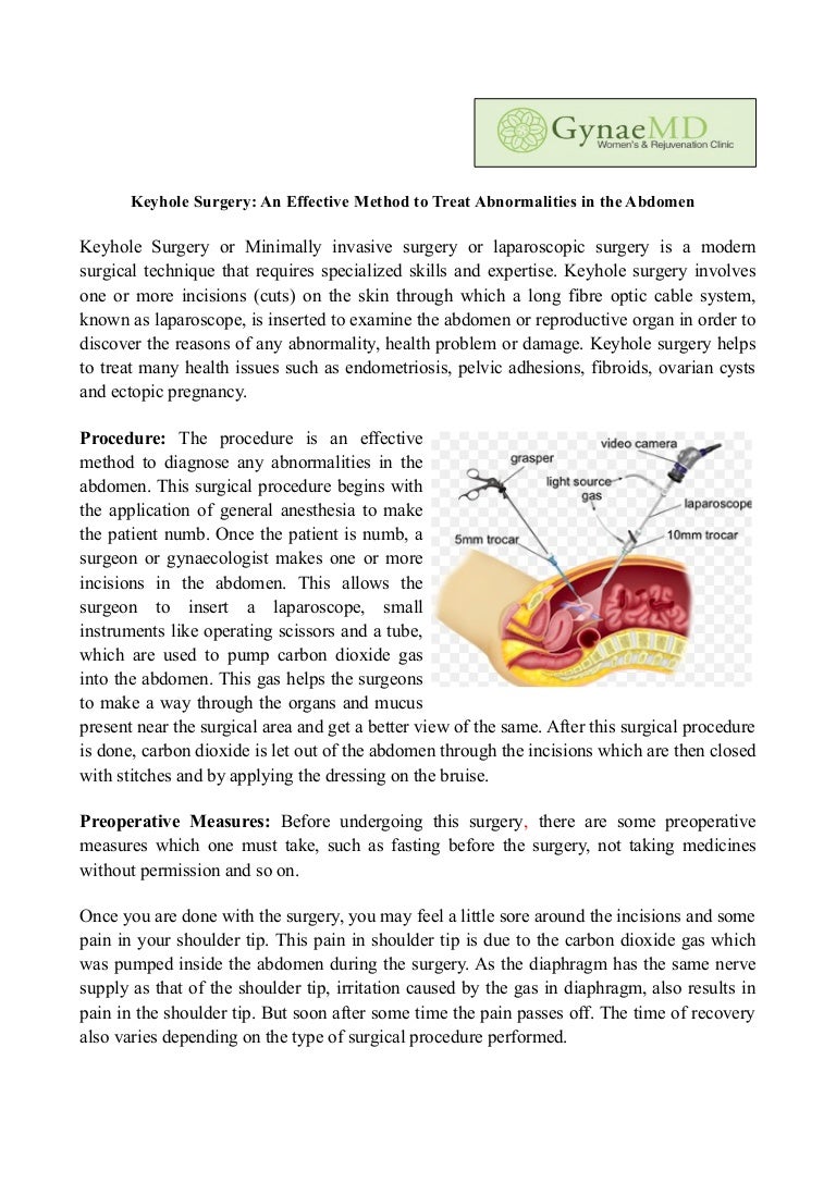 Laparoscopic procedures - a modern method of treatment Laparoscopic procedures - a modern method of treatment